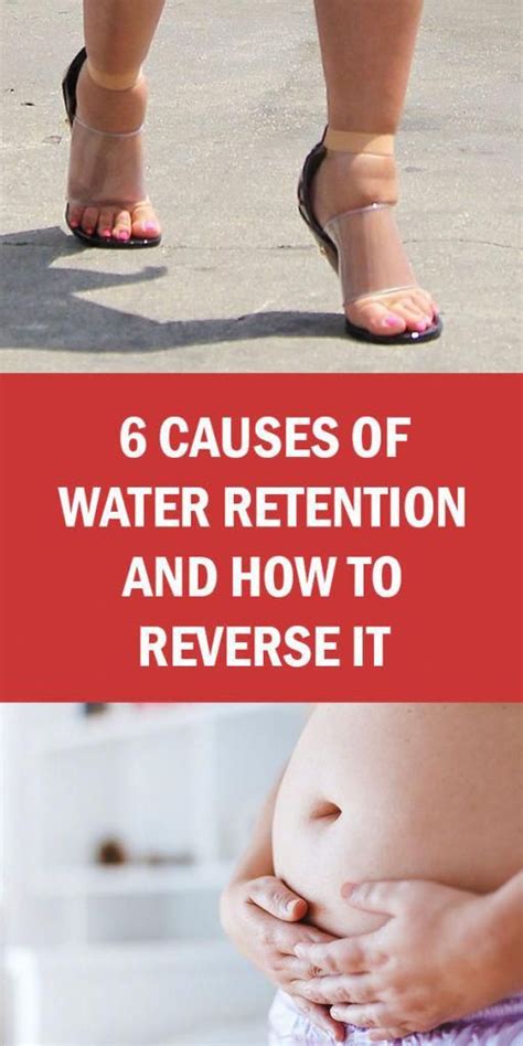 6 Causes Of Water Retention And How To Reverse It 10tipsforgoodhealth