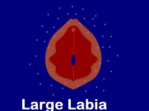 What Causes Large Labia And What You Can Do About It Health Weighup