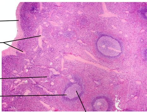 Pituitary Gland Histology Diagram Sexiz Pix My XXX Hot Girl