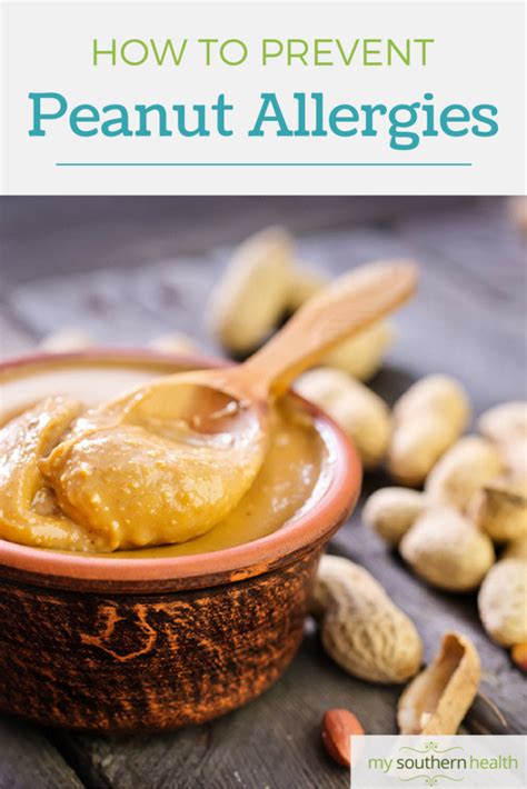 Prevent Peanut Allergies The New Peanut Allergy Recommendation