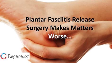 Why Surgery On Plantar Fascia Is A Bad Idea Regenexx Blog