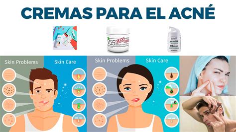 Crema Para Manchas En La Cara Por Acne Como Eliminar Las Manchas