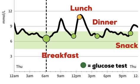 Benefits Of A Cgm Libre Or Dexcom G6 For Diabetes Control