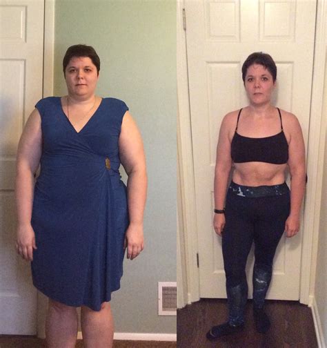 Gastric Sleeve Results