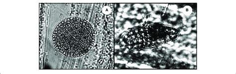 Microscopic Stages Of Seaweeds Settled Underneath The Canopies A