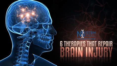 These 6 Therapies Are Repairing The Damage Of Brain Injury Right Now