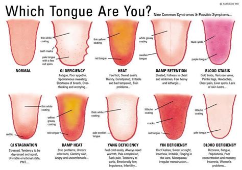 what can tongue analysis tell you about your health lifehack