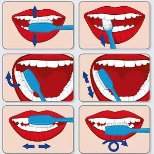 This animated step by step video explains how to brush your teeth with both conventional braces (aka: How to Brush Your Teeth Correctly - 3 Important Steps