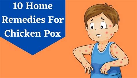 Chickenpox Treatment 10 Amazing Home Remedies For Chicken Pox Livlong