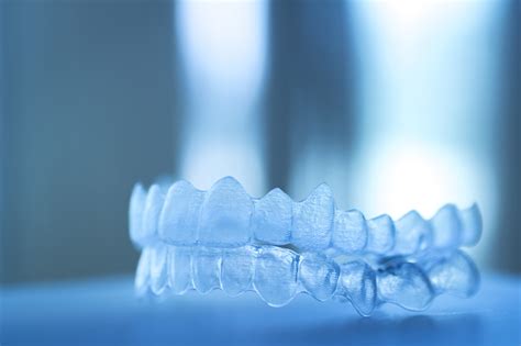 Four Reasons To Get Invisalign Ismile Orthodontics