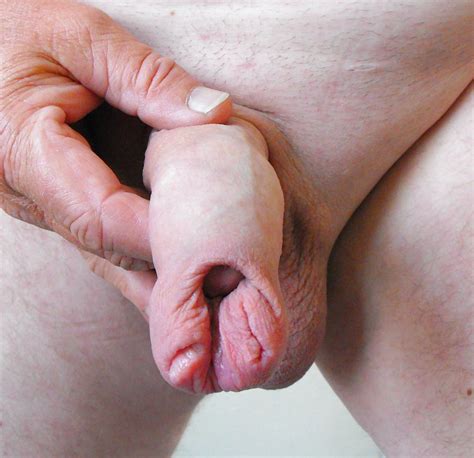 Pierced Inside Of Foreskin 5 Pics