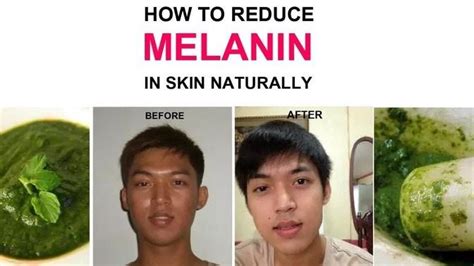 How To Reduce Melanin In Skin Naturally How To Reduce Melanin In Face