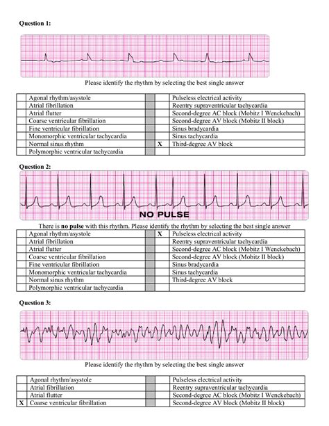 Free acls exam questions and answers 2021 pdf to pass acls practice test free. Bestseller: Acls Precourse Self Assessment Answers 2016