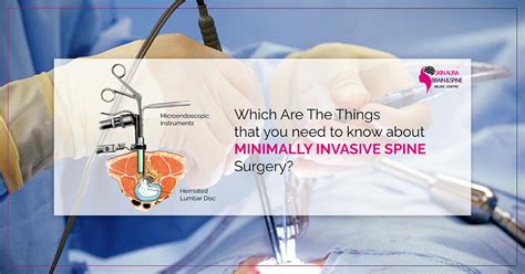 You Need To Know About Minimally Invasive Spine Surgery