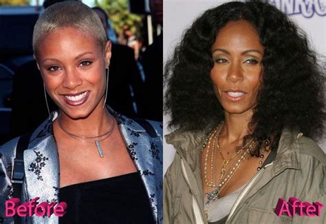 Jada Pinkett Smith Before And After Cosmetic Surgery Plastic Surgery Celebrity Plastic