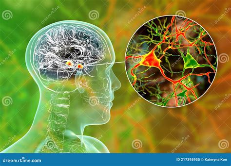 Amygdala In The Brain And Closeup View Of Amygdala Neurons 3d
