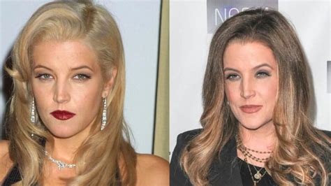 Did Lisa Marie Presley Have Plastic Surgery The 54 Year Old Star Was Accused Of Multiple
