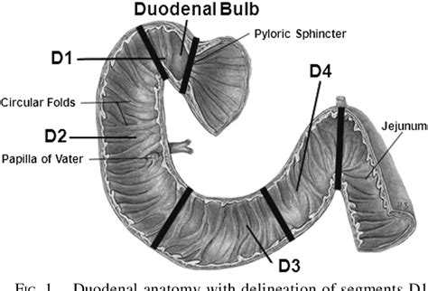 Figure 1 From Duodenal Adenocarcinoma Why The Extreme Rarity Of