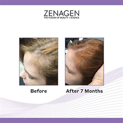 Zenagen Revolve Thickening And Hair Loss Shampoo Treatment For Women Whosellnow