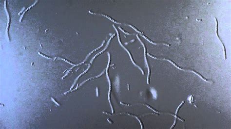 See full list on microscopemaster.com Bacteria Spirillum - DIC microscope 1000x - YouTube