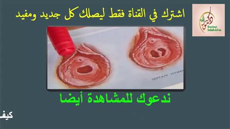 كيفية فض غشاء البكارة دكتورة مصرية تعلمك طريقة فض البكارة Youtube