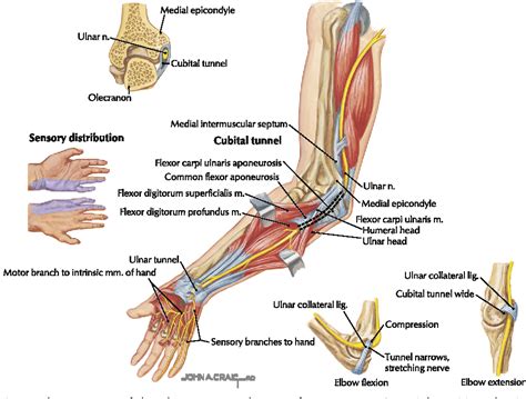 Figure 1 From Diagnosis And Treatment Of Work Related Ulnar Neuropathy