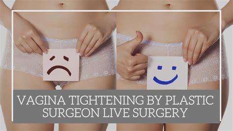 Vaginal Tightening Live Procedure By Plastic Surgeon In Ahmedabad