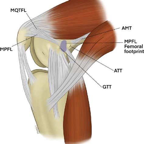 Medial View Of A Flexed Knee Is Shown Anatomy Of The Mpfl Amt
