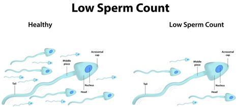 natural remedy for low sperm count male fertility sky natural health