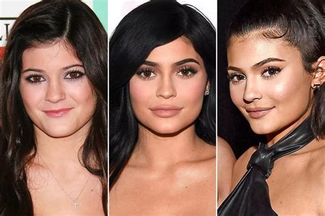 Apa Itu Lip Filler Yang Selalu Digunakan Oleh Kylie Jenner Womantalk