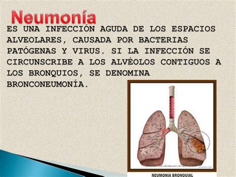 Enfermedades Del Sistema Respiratorio