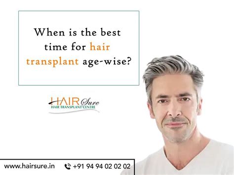 When Is The Best Time For Hair Transplant Age Wise Hair Sure