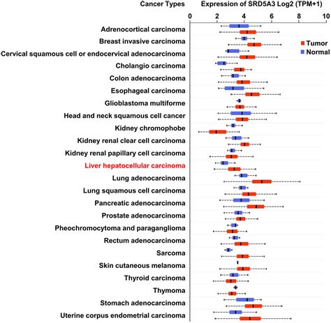 steroid 5 alpha reductase 3 srd5a3 promotes tumor growth and predicts poor survival of human