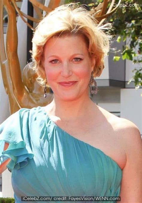 Anna Gunn Plastic Surgery Before And After