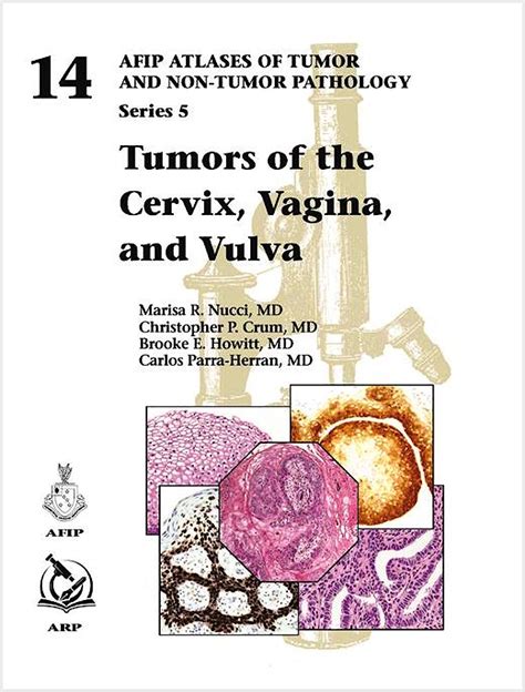 Tumors Of The Cervix Vagina And Vulva Afip Atlas Of Tumor And Non Tumor Pathology Series 5