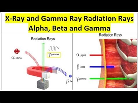 Because of its very large mass (more than 7000 times the mass of the beta particle) and its charge, it has a very short range. RT,X-Ray Radiation Rays Alpha, Beta and Gamma-Human body ...