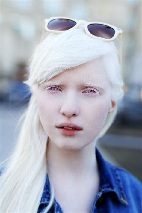 Nastya Zhidkova Albino Model With Sunglasses
