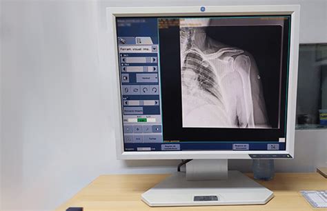 radiografia digital ortocity clínica ortopédica e de reabilitação em são paulo