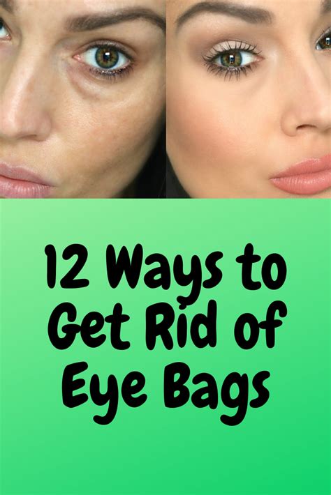 12 Ways To Get Rid Of Eye Bags Eye Bags Swelling Around The Eyes