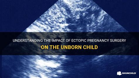Understanding The Impact Of Ectopic Pregnancy Surgery On The Unborn