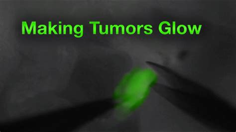 Advances In Cancer Surgery Making Tumors Glow Youtube
