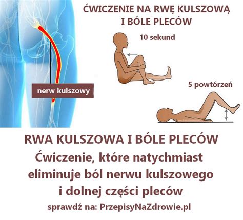 Rwa Kulszowa Objawy Leczenie Jak Boli Rwa Porn Sex Picture