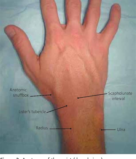 Figure 2 From A Clinical Approach To Diagnosing Wrist Pain Semantic