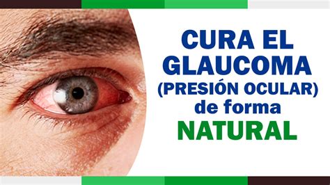 Gold Green Perú Como curar el GLAUCOMA de forma Natural Glaucoma