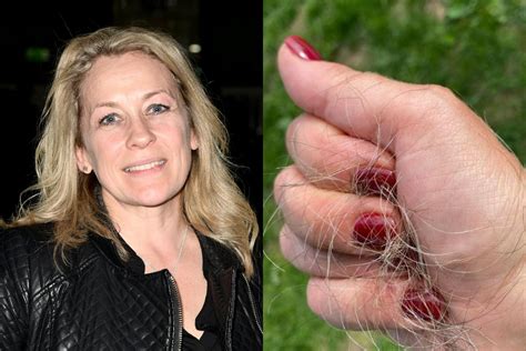 Sarah Beeny Bravely Shaves Her Hair Off Amid Breast Cancer Battle