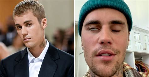Justin Bieber Says He Is Finding Comfort In Faith As He Battles Facial