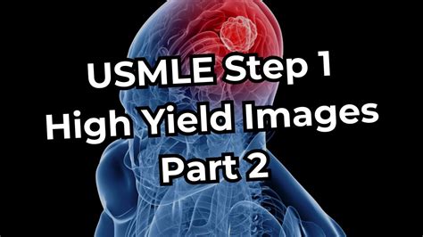 Usmle Step 1 High Yield Images Part 2 Youtube