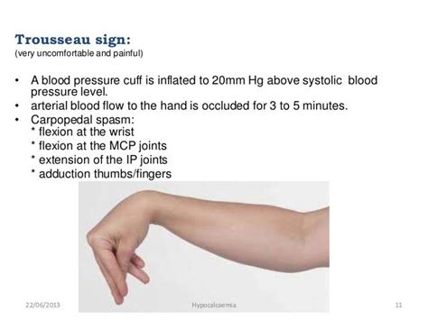 Hypocalcaemia Trousseau S Sign Nursing Mnemonics Nursing Notes