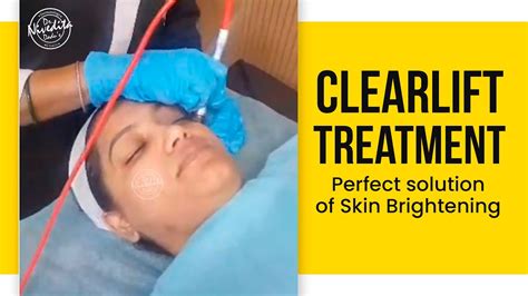 Clearlift Treatment A Perfect Solution Of Skin Brightening Youtube