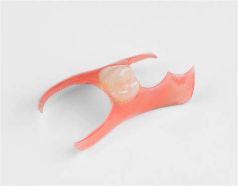 Nesbit Flexible Partial Denture Dental Lab Direct